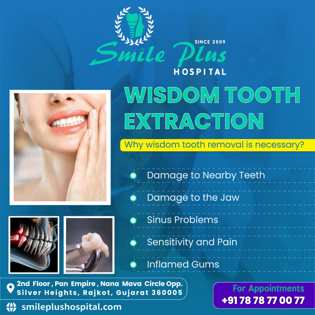 Wisdom Teeth: Why Extraction Is Often the Best Solution