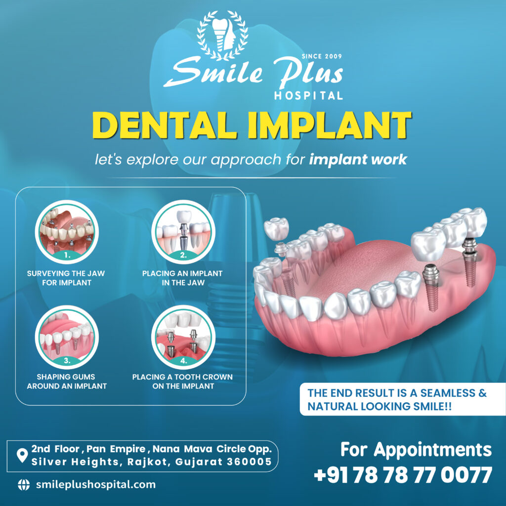 Your Journey to a New Smile Begins with Our Dental Implants