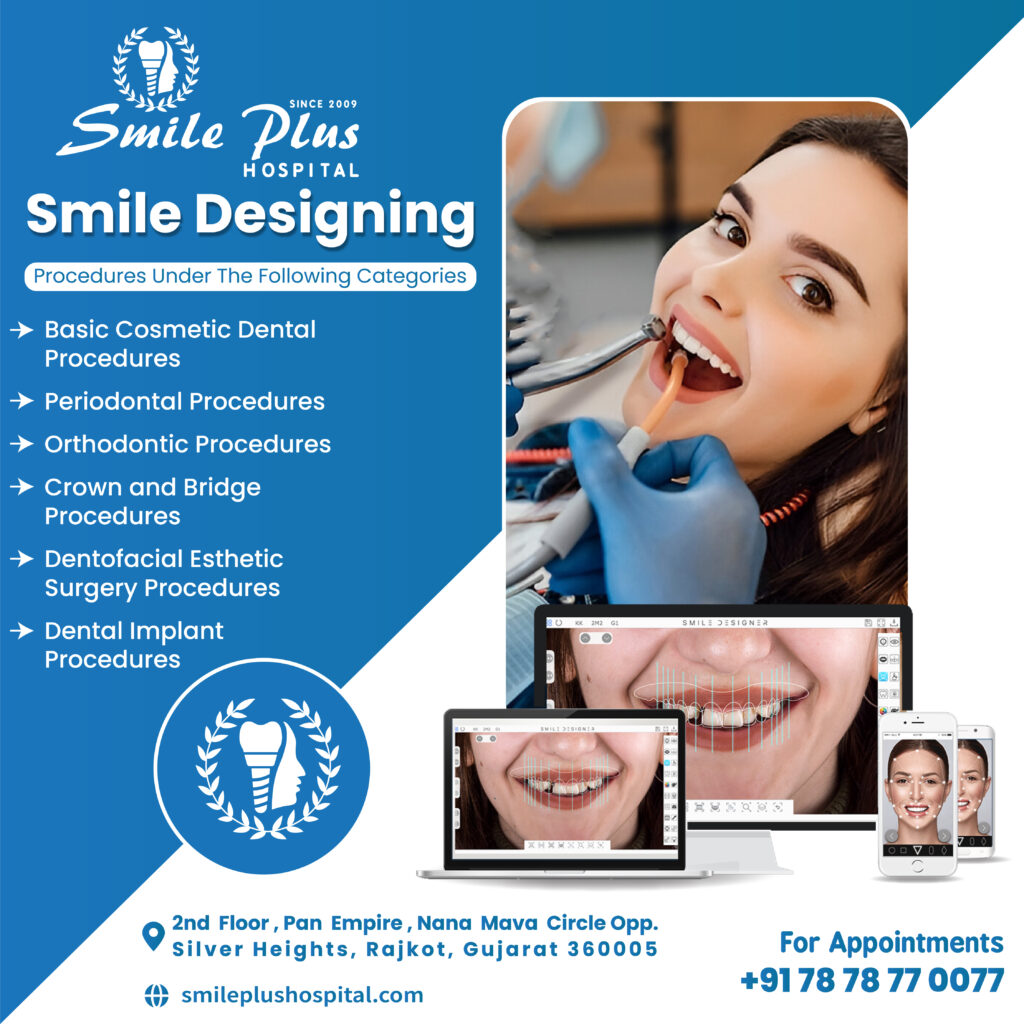 Your Perfect Smile Awaits: Tailored Smile Designing