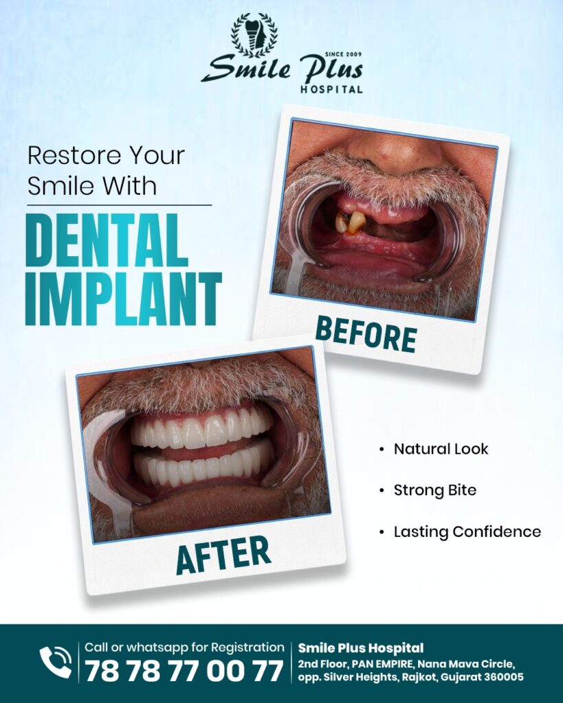 Restore Your Smile and Confidence With Dental Implants