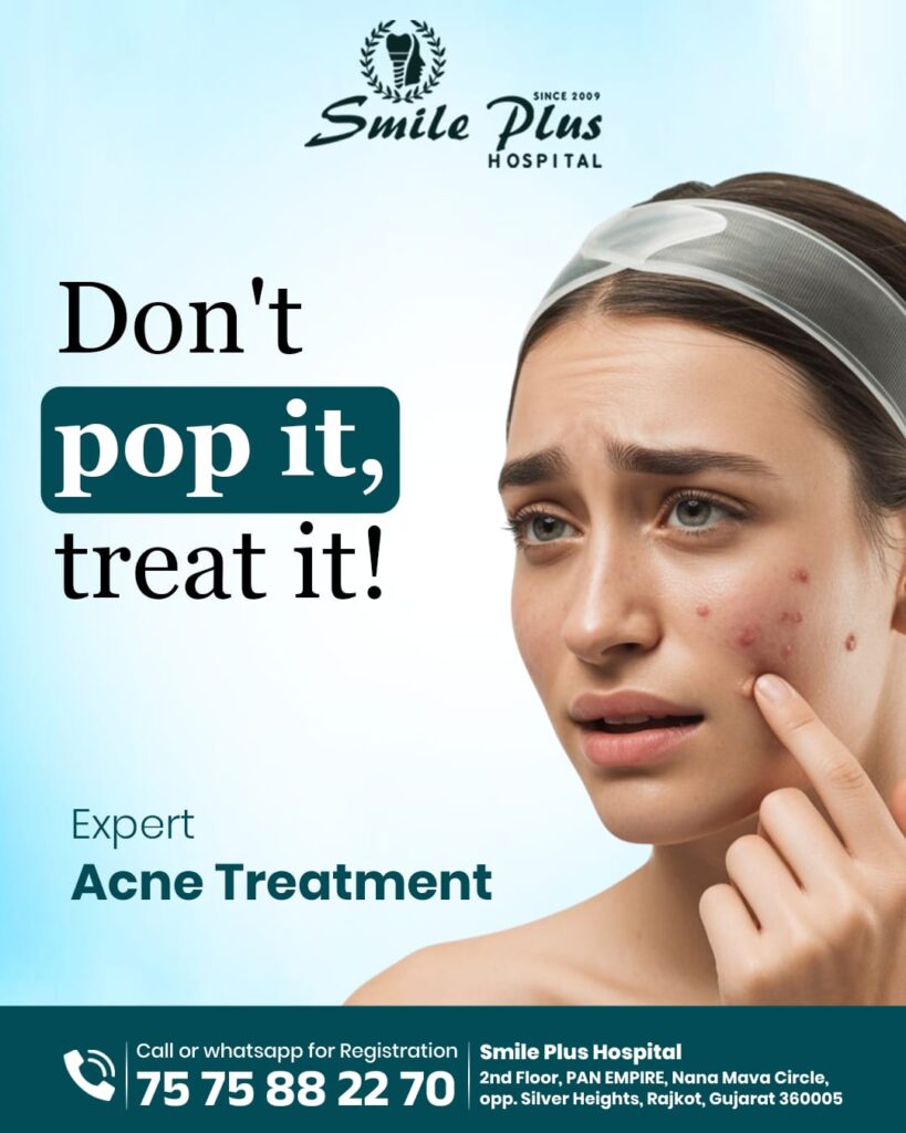 Don’t Pop It, Treat It: The Expert Approach to Acne at Smile Plus Hospital