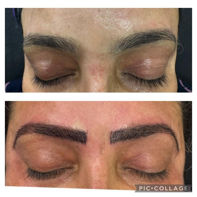 Permanent Eyebrow Treatment Before and After