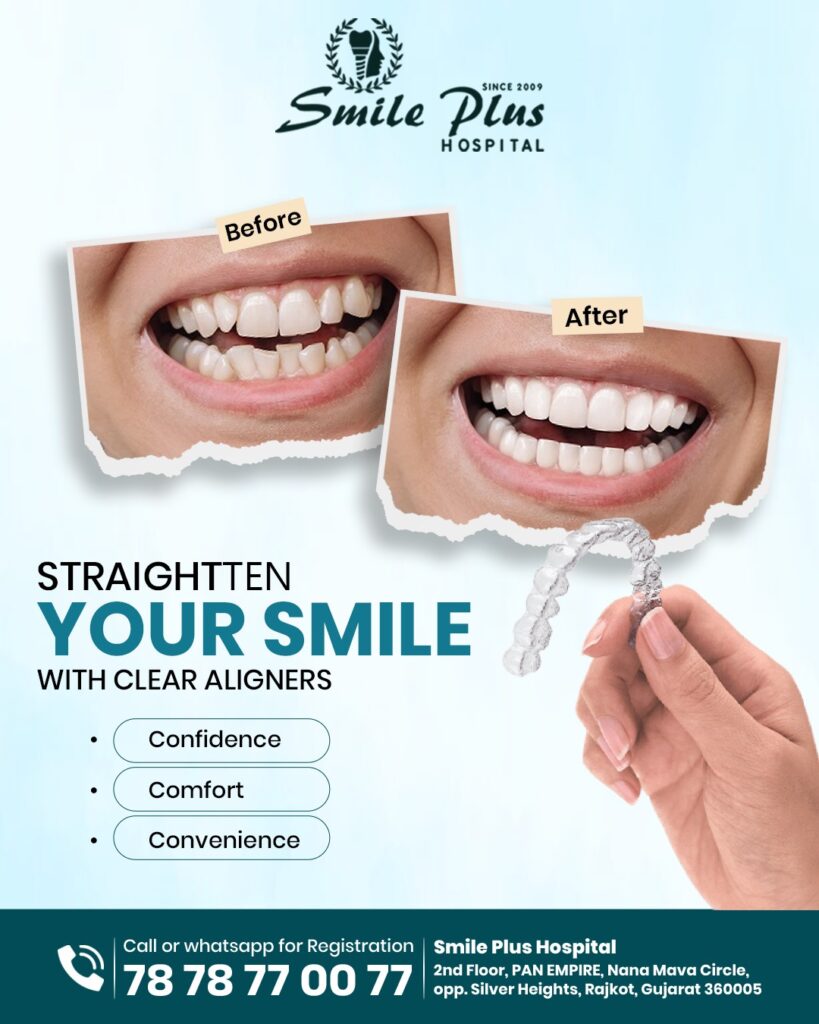 Transform Your Smile with Clear Aligners at Smile Plus Hospital